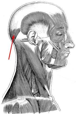 Diagram of muscles of the head