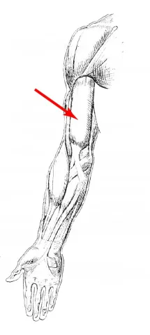Diagram of muscle of the arm