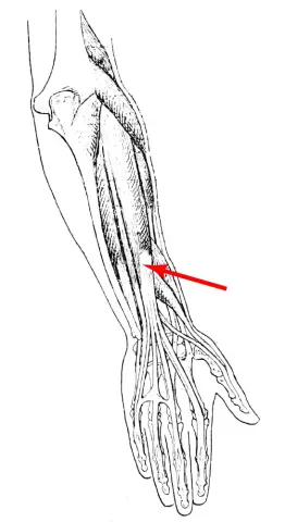 Diagram of muscle of the arm