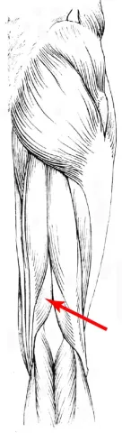 Diagram of muscles of the upper leg