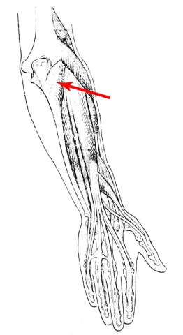 Diagram of muscle of the arm