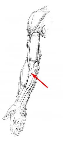 Diagram of muscle of the arm