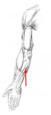 Diagram of muscle of the arm