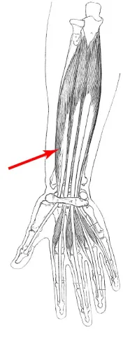 Diagram of muscle of the arm