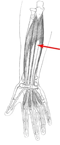 Diagram of muscle of the arm