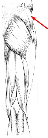 Diagram of muscles of the upper leg