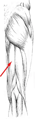 Diagram of muscles of the upper leg
