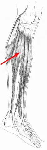 Diagram of muscles of the upper leg