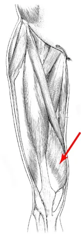 Diagram of muscles of the upper leg