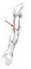 Diagram of muscle of the arm